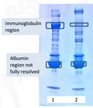 AlbuSorb™ combines with an optimized immobilized Protein A to create AlbuSorb™ PLUS