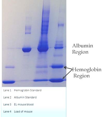 Albumin and Hemoglobin Regions