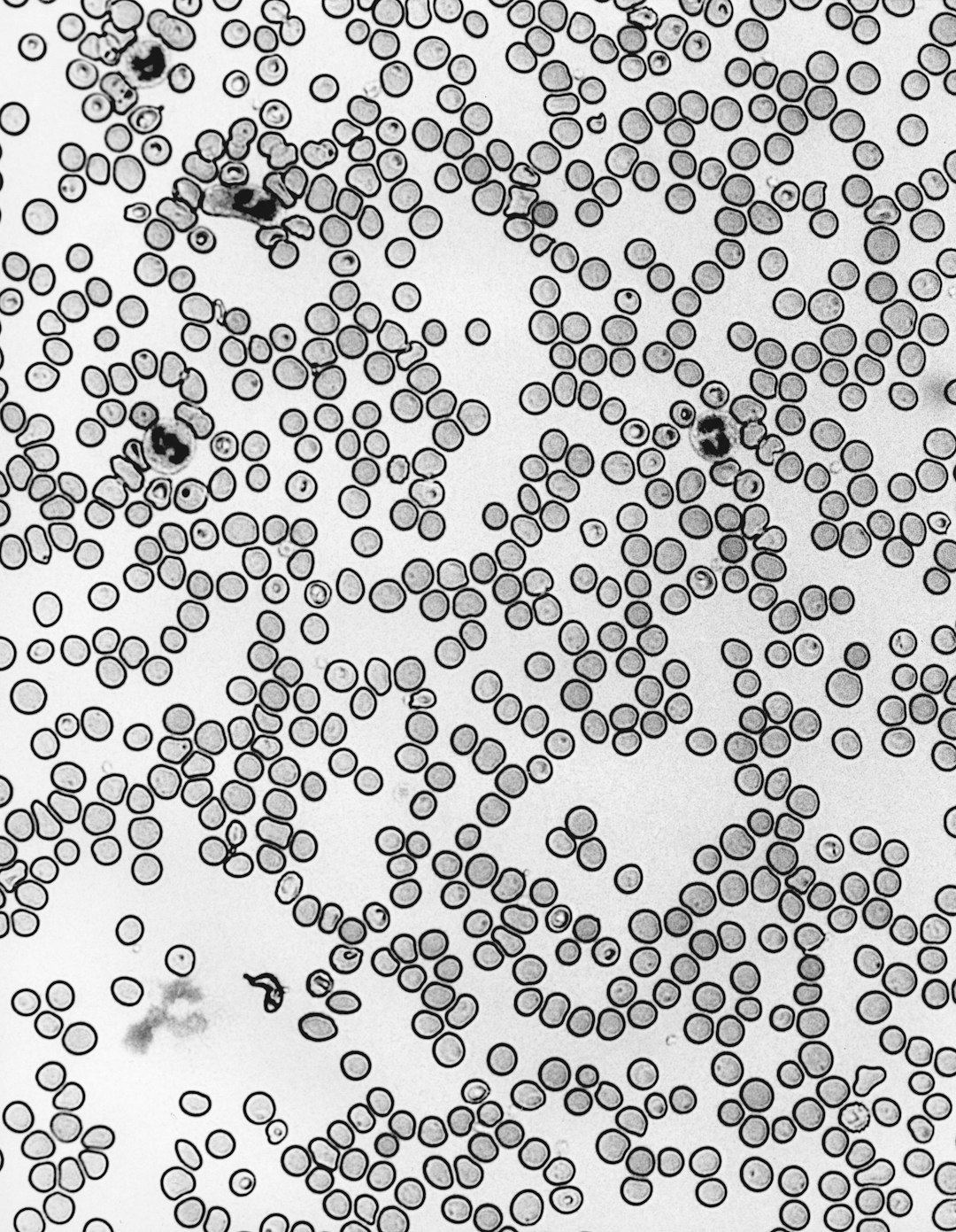 HemoVoid™ Variant Enrichment