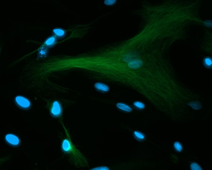 Immuno-capture Microarrays