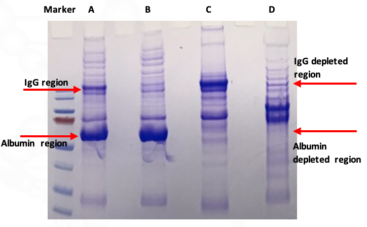 SDS-PAGE: Comparison of three methods using Human Serum Sample