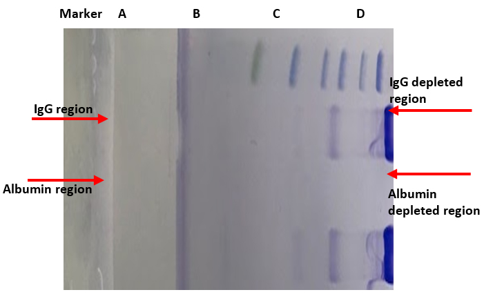 SDS-PAGE: Comparison of three methods using Human Serum Sample