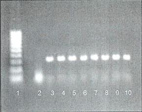 PCR from whole blood using ProPrep Genomic kit