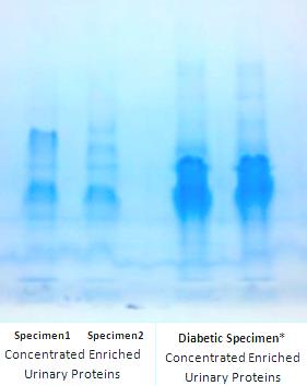 Concentrated Enriched Urinary Proteins